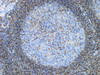 Immunohistochemistry of paraffinembedded Human tonsil tissue with CD44 Monoclonal Antibody(Antigen repaired by EDTA).