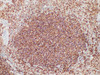 Immunohistochemistry of paraffinembedded Human tonsil tissue with CD45 (LCA) Monoclonal Antibody(Antigen repaired by EDTA).