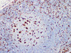Immunohistochemistry of paraffinembedded Human tonsil tissue with CD68 Monoclonal Antibody(Antigen repaired by EDTA).