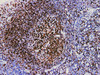 Immunohistochemistry of paraffinembedded Human tonsil tissue with CD74 Monoclonal Antibody(Antigen repaired by EDTA).