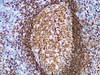 Immunohistochemistry of paraffinembedded Human tonsil tissue with CD79a Monoclonal Antibody(Antigen repaired by EDTA).