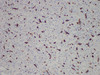 Immunohistochemistry of paraffinembedded Human liver tissue with CD163 Monoclonal Antibody(Antigen repaired by EDTA).