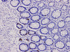 Immunohistochemistry of paraffinembedded Human colon tissue with Chromogranin A  Monoclonal Antibody(Antigen repaired by EDTA).