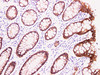 Immunohistochemistry of paraffinembedded Human colon tissue with Claudin 4 Monoclonal Antibody(Antigen repaired by EDTA).