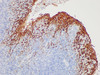 Immunohistochemistry of paraffinembedded Human tonsil tissue with Epithelial Membrane Antigen(EMA) Monoclonal Antibody(Antigen repaired by EDTA).