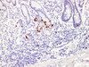 Immunohistochemistry of paraffinembedded Human stomach tissue with Gastrin Monoclonal Antibody(Antigen repaired by EDTA).