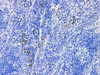 Immunohistochemistry of paraffinembedded Human lymph node tissue with Granzyme B Monoclonal Antibody(Antigen repaired by EDTA).