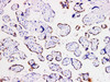 Immunohistochemistry of paraffinembedded Human placental tissue with hCGβ Monoclonal Antibody(Antigen repaired by EDTA).
