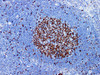 Immunohistochemistry of paraffinembedded Human tonsil tissue with Ki-67 Monoclonal Antibody(Antigen repaired by EDTA).