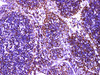 Immunohistochemistry of paraffinembedded Human lymph node tissue with MCM2 Monoclonal Antibody(Antigen repaired by EDTA).