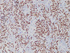 Immunohistochemistry of paraffinembedded Human testis tissue with SALL4 Monoclonal Antibody(Antigen repaired by EDTA).