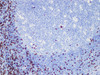 Immunohistochemistry of paraffinembedded Human tonsil tissue with CD8 Monoclonal Antibody(Antigen repaired by EDTA).