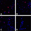 Immunofluorescence of CTLA-4 in overexpressing 293 cells using (A) RF16011, (B) RF16012, (C) RF16013, and (D) control mouse IgG antibody at 20 &#956;g/ml.