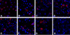 Immunofluorescence of CD80 in overexpressing HEK293 cells using (A) polyclonal CD80 antibody, (B) RF16041, (C) RF16042, (D) RF16043, (E) RF16044, (F) RF16045, (G) RF16046 and (H) control mouse IgG antibody at 2 &#956;g/ml.