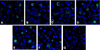 Immunofluorescence of TIGIT in over expressing HEK293 cells using (A) RF16051, (B) RF16053, (C) RF16054, (D) RF16055, (E) RF16056, (F) RF16058, and (G) control mouse IgG antibody at 1 &#956;g/ml.