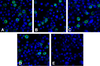 Immunofluorescence of LIGHT in overexpressing HEK293 cells using (A) RF16061, (B) RF16062, (C) RF16063, (D) RF16064, and (E) control mouse IgG antibody at 2 &#956;g/ml.