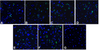 Immunofluorescence of TIM-3 in over expressing HEK293 cells using (A) RF16103, (B) RF16105, (C) RF16106, (D) RF16107, (E) RF16108, (F) RF16109, and (G) control mouse IgG antibody at 10 &#956;g/ml.