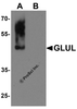 Western blot analysis of GLUL in human brain tissue lysate with GLUL antibody at 0.5 &#956;g/mL in (A) the absence and (B) the presence of blocking buffer.