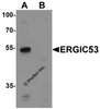 Western blot analysis of ERGIC53 in HL60 cell lysate with ERGIC53 antibody at 1 &#956;g/mL in (A) the absence and (B) the presence of blocking buffer.