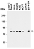 <strong>Figure 1 Western Blot Validation in Human Cell Lines</strong><br>
Loading: 15 &#956;g of lysates per lane.
Antibodies: IRAK 1007 (1 &#956;g/mL), 1h incubation at RT in 5% NFDM/TBST.
Secondary: Goat anti-rabbit IgG HRP conjugate at 1:10000 dilution.