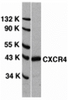 <strong>Figure 1 Western Blot Validation of CXCR4 in HeLa Cells </strong><br> Loading: 15 &#956;g of lysates per lane. Antibodies: 1009 (1 &#956;g/mL), 1 h incubation at RT in 5% NFDM/TBST. Secondary: Goat anti-rabbit IgG HRP conjugate at 1:10000 dilution.