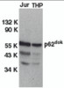 Western blot analysis of DOK1 in Jurkat (Jur) and THP-1 (THP) cell lysates with DOK1 antibody at 1 &#956;g/mL.