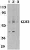 Western blot analysis of CCR3 in human spleen tissue lysates with CCR3 antibody at 1 (lane 1) and 2 &#956;g/mL (lane 2), and 2 &#956;g/mL in the presence of blocking peptide (lane 3).