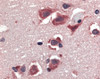 Immunohistochemistry of TRAIL in human brain tissue with TRAIL antibody at 20 &#956;g/mL.