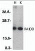 Western blot analysis of RAIDD in whole cell lysates from HeLa (H) or K562 (K) cells with RAIDD antibody at 1:500 dilution.