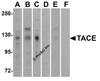 <strong>Figure 1 Western Blot Validation of TACE in Human Cell Lines</strong><br> Loading: 15 &#956;g of lysates per lane. Antibodies: TACE (1 µg/mL), 1h incubation at RT in 5% NFDM/TBST. Secondary: Goat anti-rabbit IgG HRP conjugate at 1:10000 dilution. Lanes: HeLa (A,D), Jurkat (B, E), Raji (C,F) in the absence (A-C) or presence (E-F) of blocking peptide.