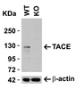 <strong>Figure 2 KO Validation in HeLa Cells</strong><br>  Loading: 10 &#956;g of HeLa WT cell lysates or TACE KO cell lysates. Antibodies:  TACE 1131 (0.25 &#956;g/mL) and beta-actin 3779 (1 &#956;g/mL), 1 h incubation at RT in 5% NFDM/TBST. Secondary: Goat Anti-Rabbit IgG HRP conjugate at 1:10000 dilution.