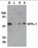 Western blot analysis of GFR alpha 1 in crude membrane fractions of human brain (B), liver (L), kidney (K), and spleen (S), respectively, with GFR alpha 1 antibody at 1 &#956;g/mL.