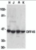 Western blot analysis of DFF45 in HeLa (H), Jurkat (J), A431 (A), and K562 (K) whole cell lysate with DFF45 antibody at 1:1000 dilution.