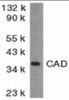 Western blot analysis of CAD in mouse kidney tissue lysate with CAD antibody at 2 &#956;g/mL.