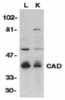 Western blot analysis of CAD in mouse lung (L) and kidney (K) tissue lysates with CAD antibody at 1:500 dilution.