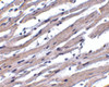 Immunohistochemistry of Apaf1 in human heart tissue with Apaf1 antibody at 1 ug/mL.