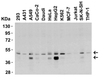 Figure 1 Western Blot Validation in Human Cell Lines
Loading: 15 &#956;g of lysates per lane.
Antibodies: DR5 2019, (0.5 &#956;g/mL) , 1h incubation at RT in 5% NFDM/TBST.
Secondary: Goat anti-rabbit IgG HRP conjugate at 1:10000 dilution.