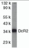 Western blot analysis of DcR2 in HeLa whole cell lysate with DcR2 antibody at 1 &#956;g/mL.