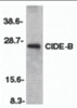 Western blot analysis of CIDE-B in mouse liver tissue lysate with CIDE-B antibody at 1:500 dilution.