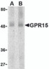Western blot analysis of GPR15 in human spleen lysate with GPR15 antibody at (A) 0.5 and (B) 1 &#956;g/mL.