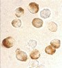 Immunocytochemistry staining of HeLa cells using IKK beta antibody at 10 ug/mL.