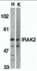 Western blot analysis of IRAK2 in HeLa (H) and K562 (K) whole cell lysate with IRAK2 antibody (C2) at 2 &#956;g/mL.