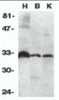 Western blot analysis of DcR3 in human heart (H) , brain (B) , and kidney (K) tissue lysates with DcR3 antibody at 1:500 dilution.