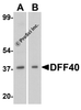 Western blot analysis of DFF40 in (A) K562 and (B) and Jurkat cell lysate with DFF40 antibody at 1 &#956;g/mL.