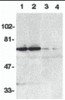 Western blot analysis of DR6 in K562 (1, 3) and Raji (2, 4) whole cell lysate in the absence (1, 2) or presence (3, 4) of blocking peptide (Catalog no. 2157P) with DR6 antibody at 1:500 dilution.