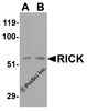Western blot analysis of RICK in (A) 3T3 and (B) K562 cell lysate with RICK antibody at 0.5 μg/mL
