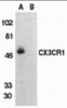 Western blot analysis of CX3CR1 in THP-1 cell lysate with CX3CR1 antibody at 1 &#956;g/mL in (A) the absence and (B) the presence of blocking peptide.