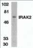 Western blot analysis of IRAK2 in K562 whole cell lysate with IRAK2 antibody at 1:500 dilution.