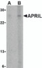 Western blot analysis of APRIL expression in K562 cells with APRIL antibody at (A) 5 and (B) 10 &#956;g/mL.