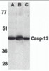 Western blot analysis of caspase-13 in human HL60 cell lysate (A) , mouse brain (B) and rat brain (C) tissue lysates with caspase-13 antibody at 1 &#956;g/mL.